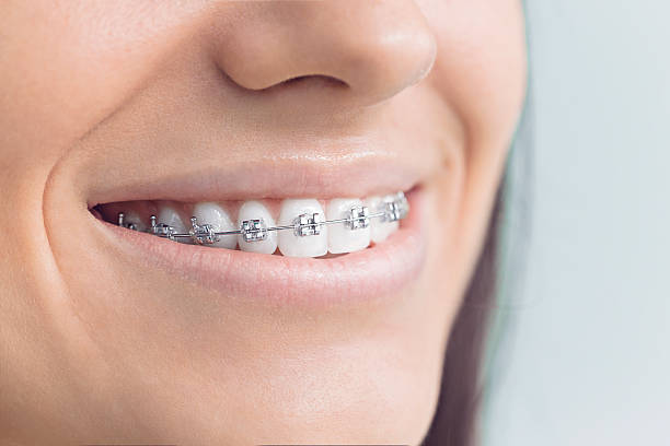 Trusted Grain Valley, MO Dental Services Experts